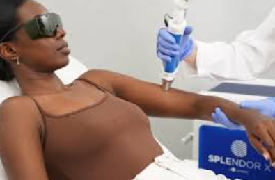 Laser hair removal is suitable for dark skin.